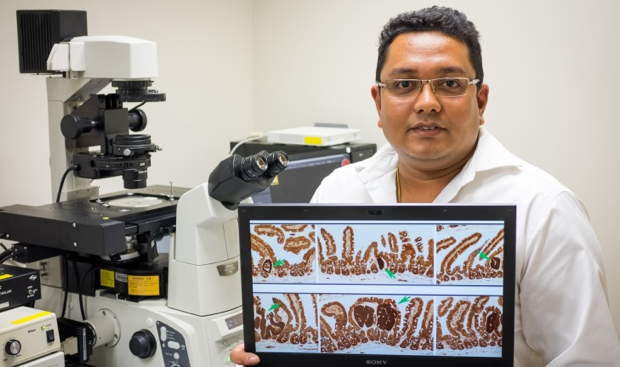 NTU scientists discover new treatment options for colon cancer